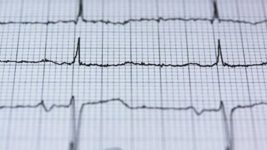 catalyst pulse start 8882060974