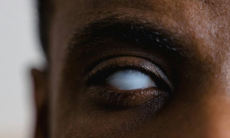 radiant surge starts shaping potential